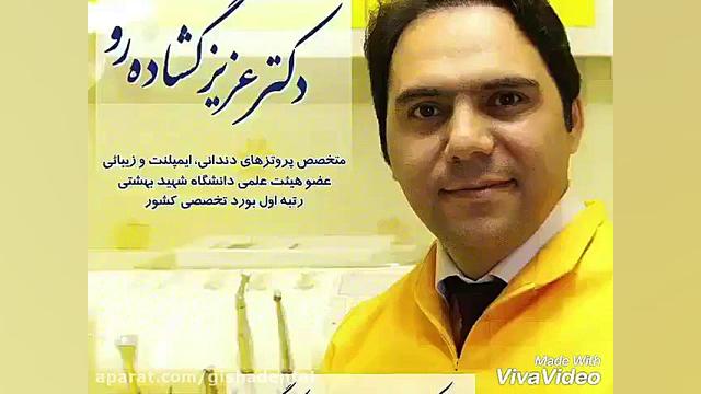 ایمپلنت کل دندانها در فردی با بی دندانی کامل توسط متخصص کلینیک دندانپزشکی دکتر عزیز گشاده رو