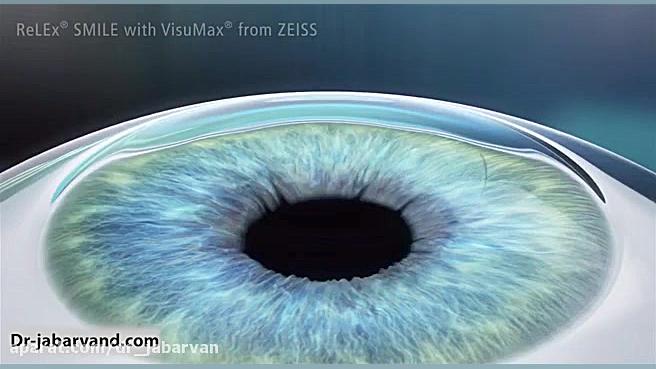 SMILE ANIMATION دکتر محمود جباروند بهروز