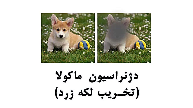 دژنراسیون ماکولا یا تخریب لکه زرد چیست؟ مزوتراپی