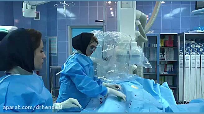 آنژیوگرافی از طریق پا جراحی بینی
