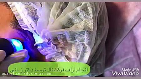 ویدیو کوتاهی از آراف فرکشنال در آقایان جرمگیری