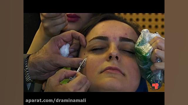 تزریق بوتاکس تریلر تصویربرداری بالینی