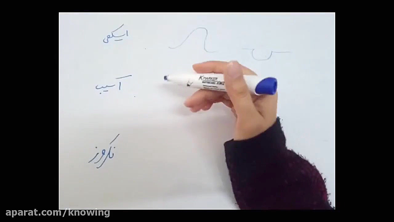 تغییرات ECG در MI کامپوزیت ونیر