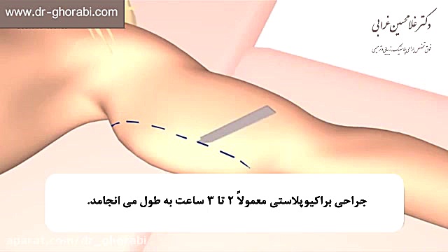 لیفت بازو (براکیوپلاستی) دکتر غلامحسین غرابی