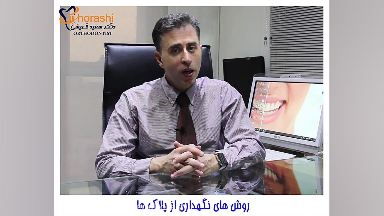 نگه داری پلاک های متحرک پس از ارتودنسی-دکترسعید قریشی دکتر سعید قریشی
