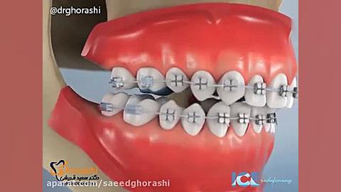 بایت خلفی-دکتر سعید قریشی دکتر سعید قریشی