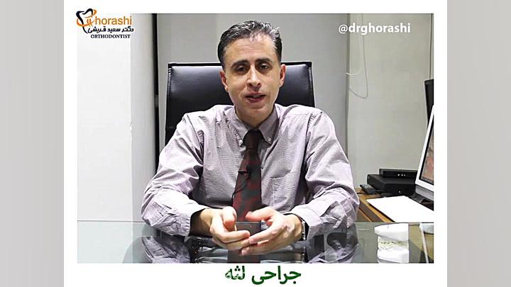 جراحی لثه-دکتر سعید قریشی دکتر سعید قریشی