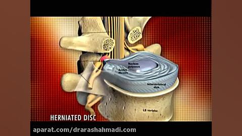 ازون تراپی دکتر آرش احمدی--88309717-88846132