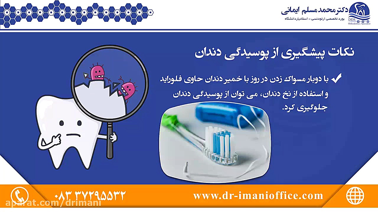 نکات پیشگیری از پوسیدگی دندان دکتر محمد مسلم ایمانی - متخصص ارتودنسی در کرمانشاه