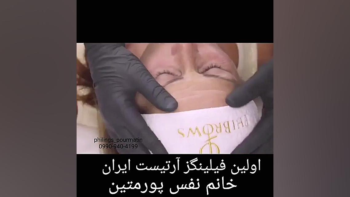 میکرونیدلینگ و فیلینگز هیدروراکس