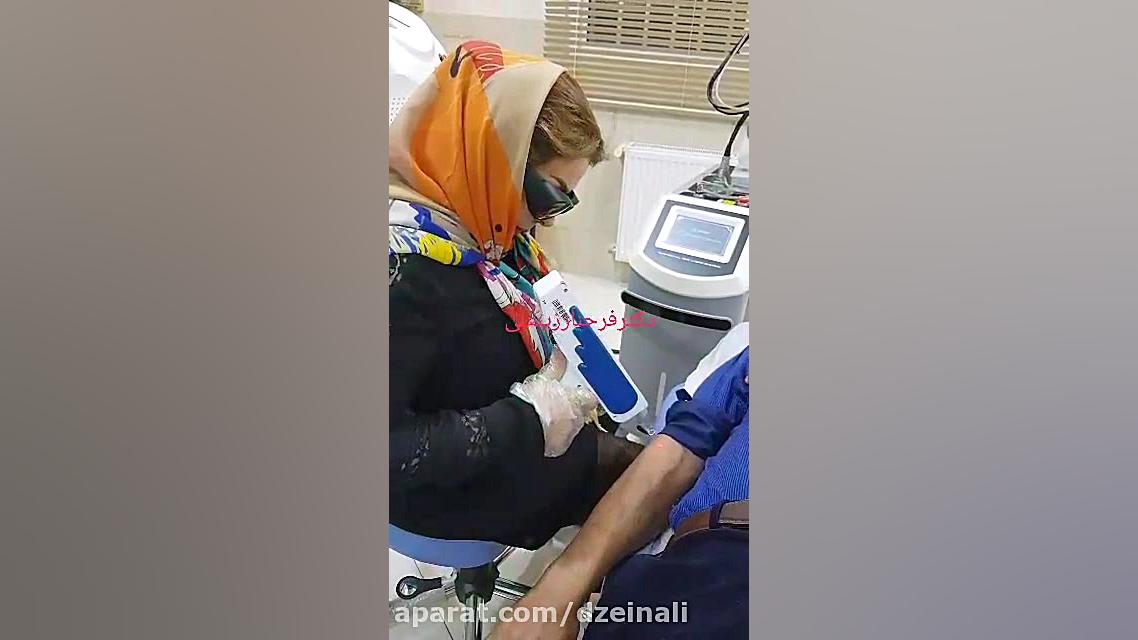 لیزر کیوسویچ برای رفع دائمی خالکوبی وتاتوی بدن وصورت دکتر فرحناز زینعلی - متخصص پوست، مو، زیبایی زنجان