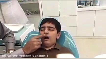 کشیدن دندان تحت بیحسی هیپنوتیزمی(دکتر فتحی) بیماری دیستروفی لیمب-گیرل