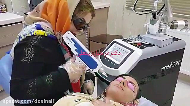 انجام لیزر کیوسوییچ برای رفع کامل فرکل (لکها و کک ومک) دکتر فرحناز زینعلی - متخصص پوست، مو، زیبایی زنجان