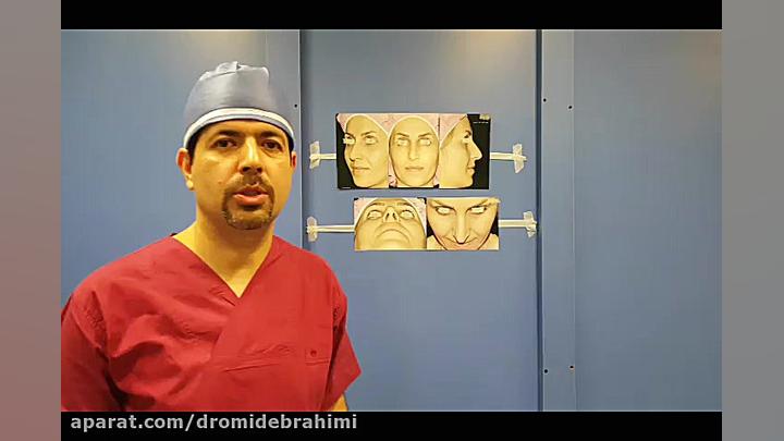 نمونه کار بینی استخوان قوزدار از بهترین جراح بینی دکتر امید ابراهیمی