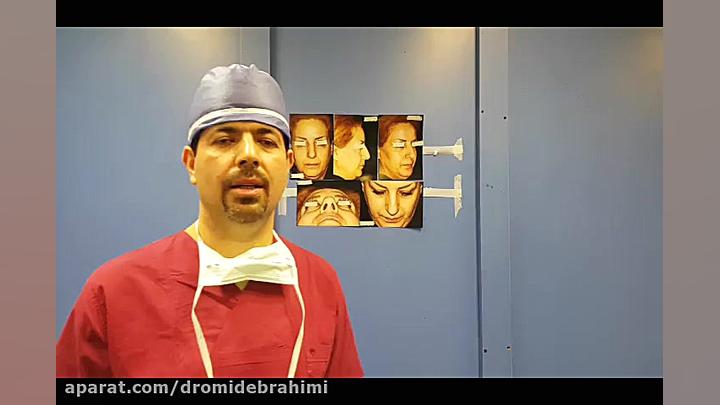 نمونه کار جراحی بینی گوشتی قوزدار از بهترین جراح بینی دکتر امید ابراهیمی