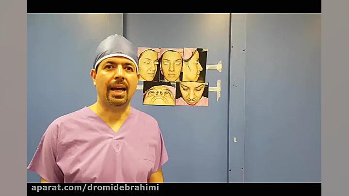 نمونه کار جراحی بینی گوشتی و قوزدار از بهترین جراح بینی دکتر امید ابراهیمی