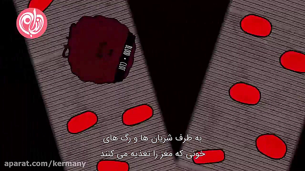 از سکته مغزی چه می دانید؟ دندانپزشک زیبایی