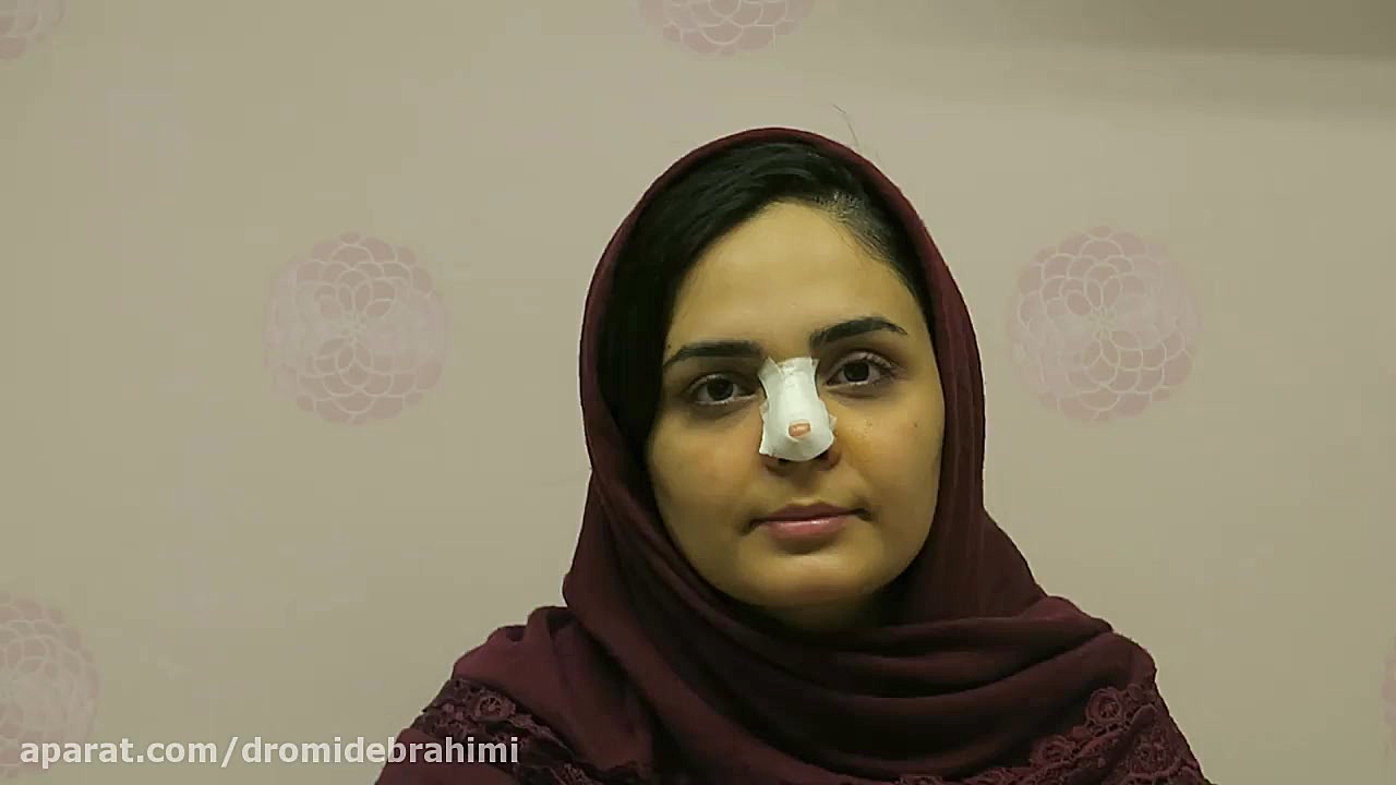 رضایتمندی بیماران از بهترین جراح بینی دکتر امید ابراهیمی