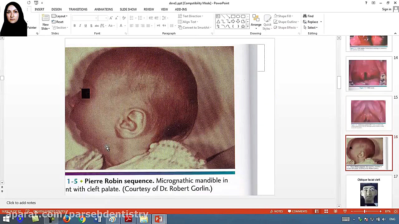 فیلم تطابق با آزمون 96 درس پاتولوژی - سوال 1 ابرسانی پوست