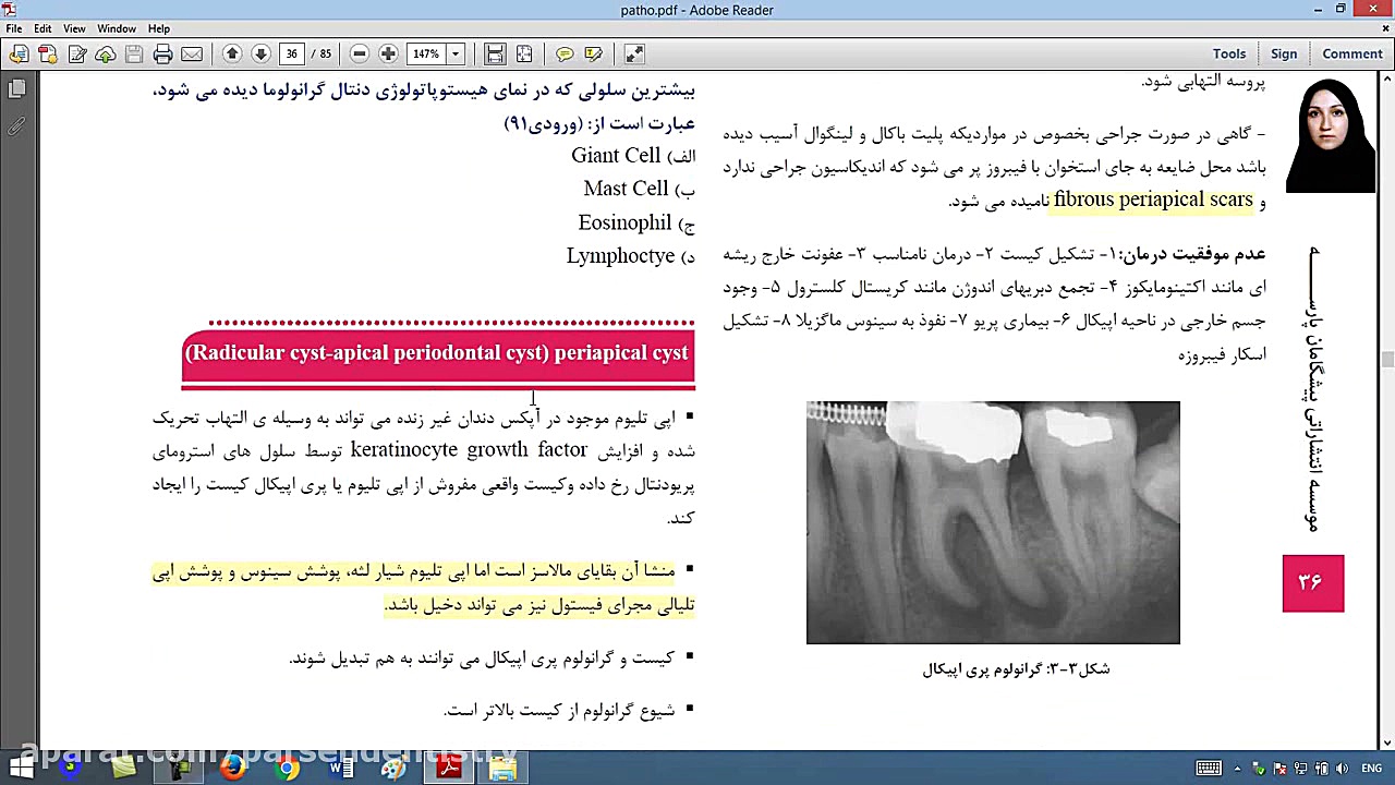 فیلم تطابق با آزمون 96 درس پاتولوژی - سوال 3 ترمیم لبخند لثه‌ای