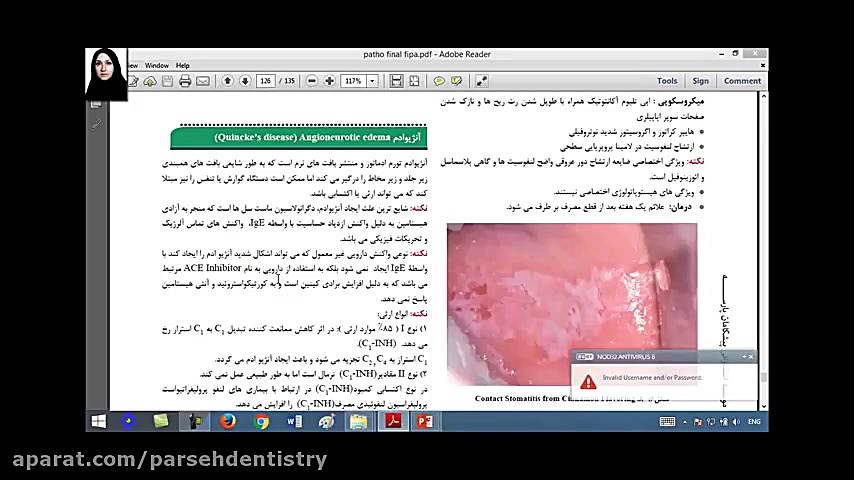 فیلم تطابق با آزمون 96 درس پاتولوژی - سوال 6 کلینیک لیزر