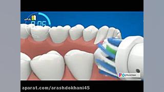 روش استفاده از مسواک برقی دکتر آرش دخانی